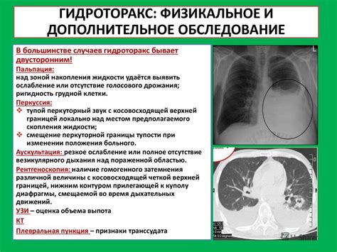 Диагностика наличия воды в легких