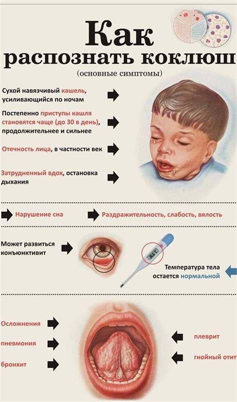 Коклюш: основные признаки и последствия