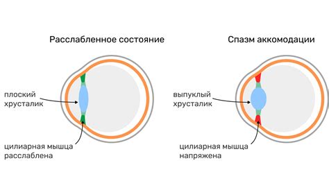 Причины спазма аккомодации глаз